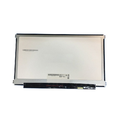 15.6 Inch Laptop LCD Panel Screen B156ZAN02.0 For Dell lcd screen